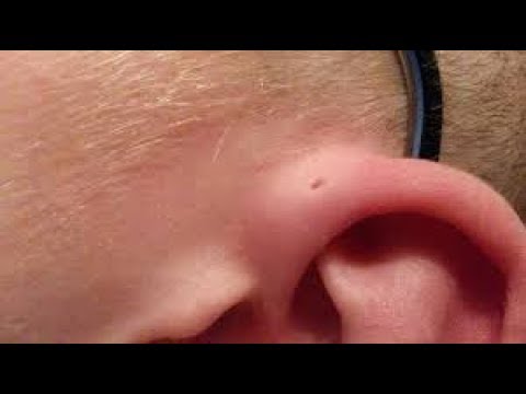 Only A Handful Of People Have These Tiny Holes By Their Ears – And Here’s The Fascinating Reason Why