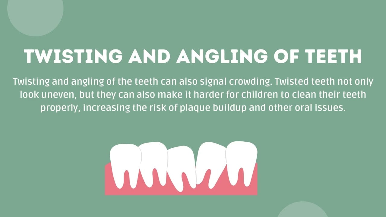 Common Signs of Crowding in Children's Teeth