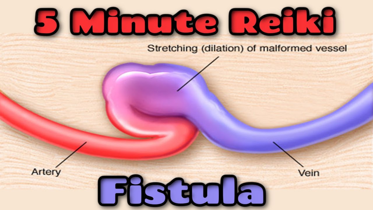 Reiki For Fistula l 5 Min Session l Healing Hands Series