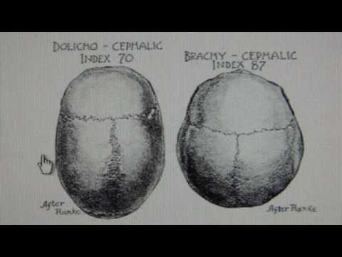 Swiss have Khazarian Brachycephalic Craniometry Cephalometry from Central Asia Mongolia