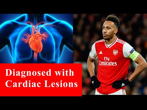Vaccinated players Pierre Aubameyang, Axel Meyé, and Mario Lemina, diagnosed with  cardiac lesions at the Africa Cup of Nations