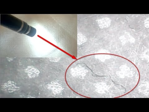 Nanobot Worms in the Face Mask - Endoscope Camera View