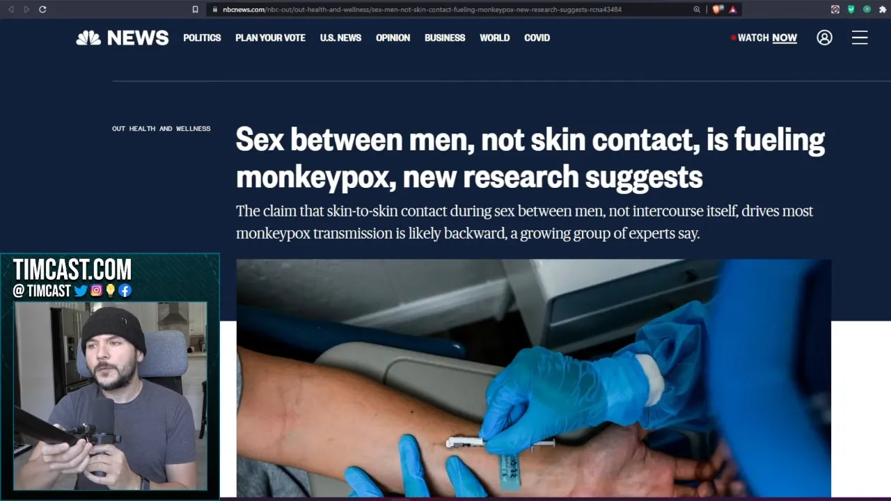 NBC Says MonkeyPox IS Mostly Spread Via Sex, Children And Dog Contracting Virus Sparks Controversy