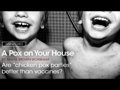 Chicken Pox Parties are not Biblical
