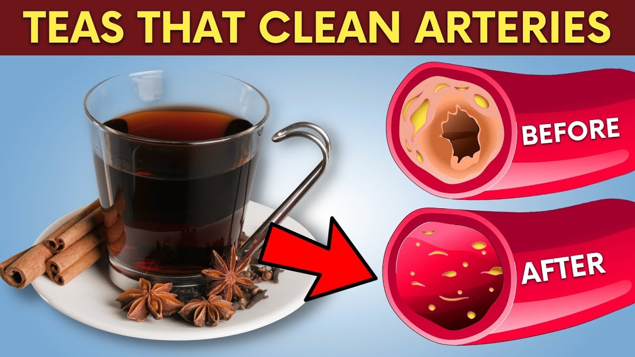 Only 5 Herbal Teas that CLEAN Arteries and Normalize High Blood Pressure