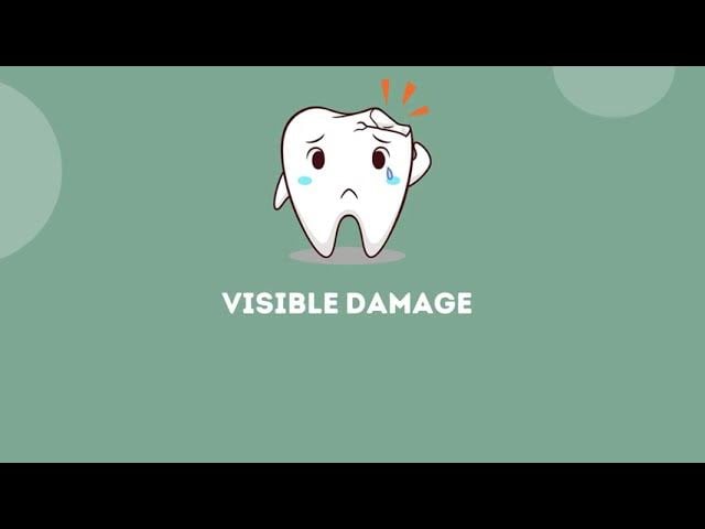 Signs and Symptoms of Premature Tooth Loss