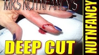 Mrs Nutn Cuts Finger Bad