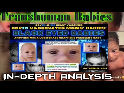 BLACK EYED BABIES   DOCTOR SAYS BABIES ARE MUTANTS