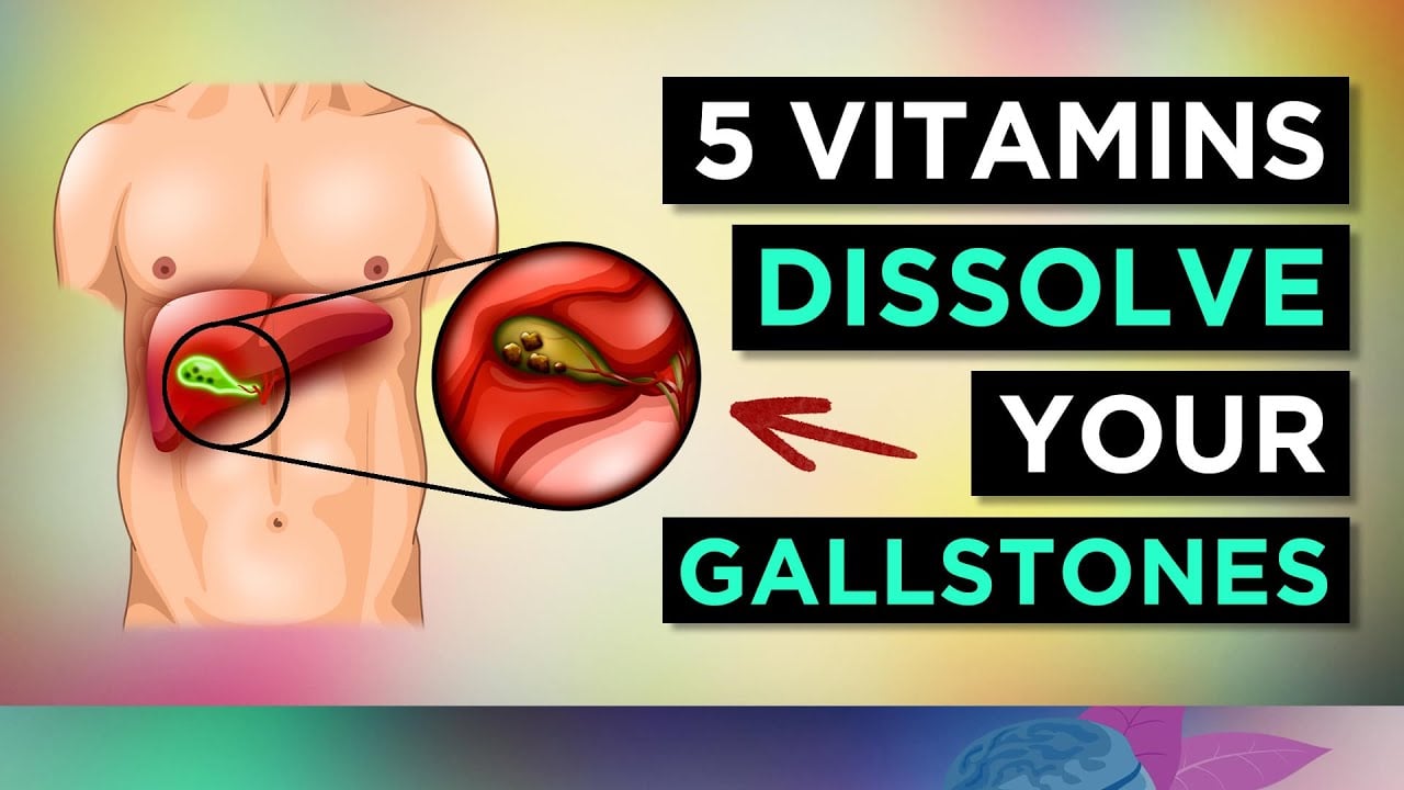 5 Vitamins To DISSOLVE Your GALLSTONES