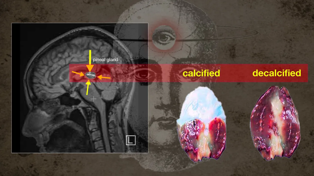 Wake Up Even More; We can finally decalcified our pineal gland! Here's how