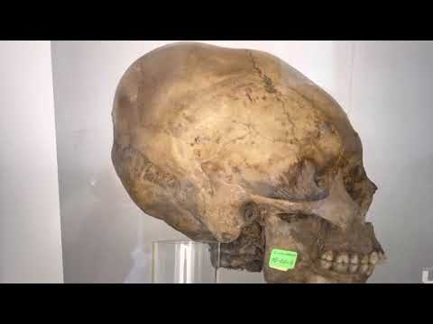 More Elongated Skulls Of Ancient Peru