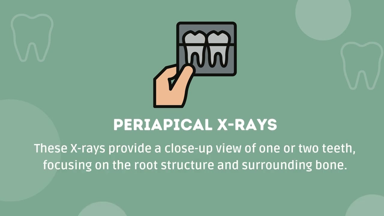 Understanding Pediatric Dental X-Rays