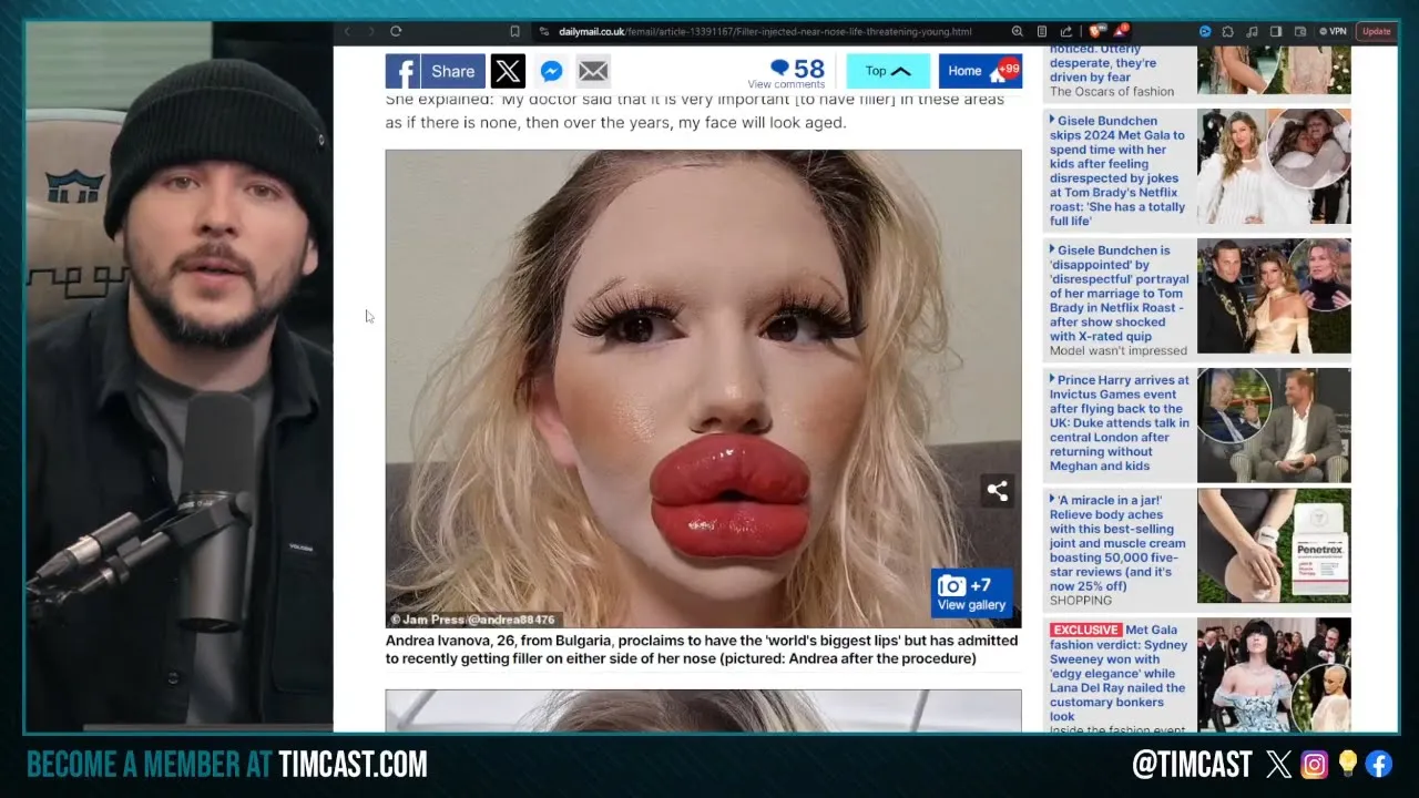 Gen Z Is ADDICTED To Plastic Surgery Because Of Social Media, Even Men Try To Look Like Filter
