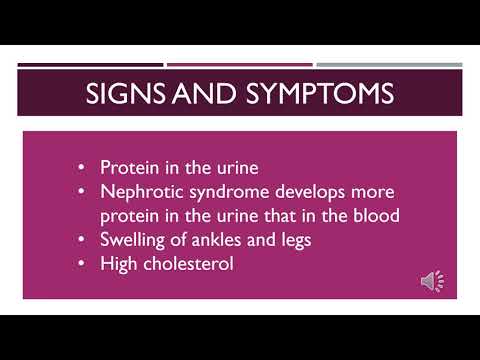 AA Amyloidosis (and the Cancers It Causes)