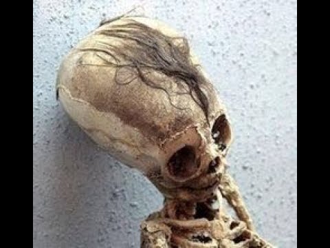 FINALLY: DNA Results Of The Paracas Elongated Skulls Of Peru: Part 1