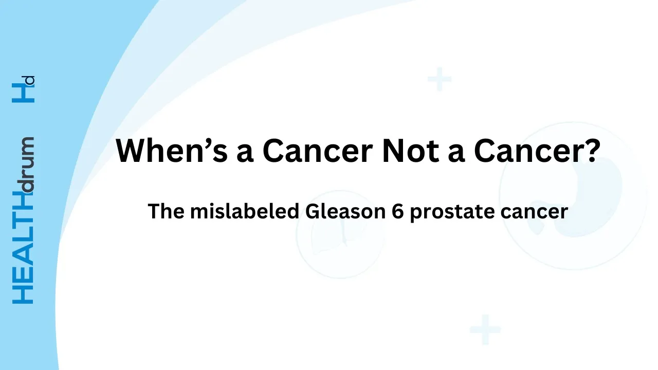 when's a cancer not a cancer?: the mislabeled Gleason 6 prostate cancer