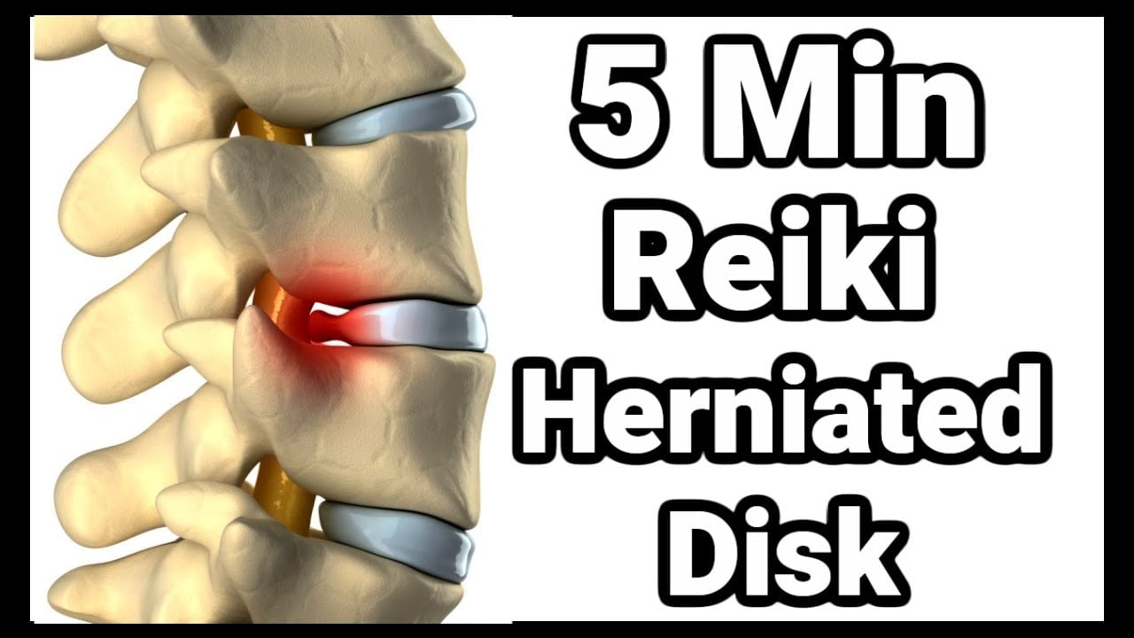 Reiki l Herniated Disk l 5  Minutes Session l Healing Hands Series l 963 Hz
