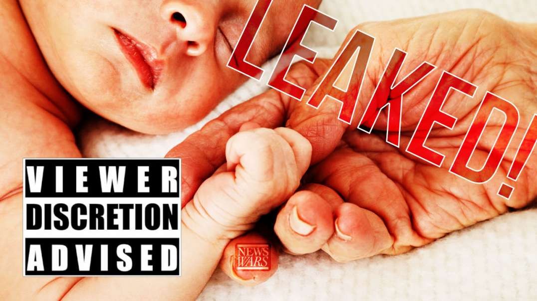 VIEWER DISCRETION ADVISED: Leaked Post-Birth Abortion Footage