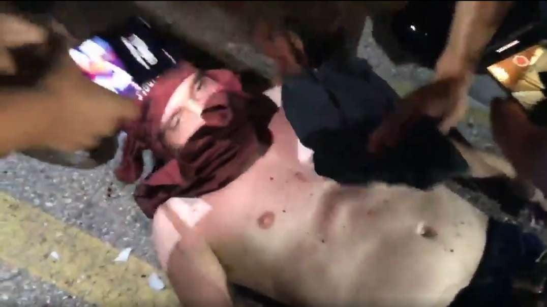 Rioter shot in Head : ) LARP medics pressing a scarf into a gunshot wound