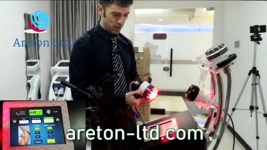 Dispositivo de radiofrecuencia RF con Vacio para tratamientos corporales aplicado a Andreas Russo.mp4