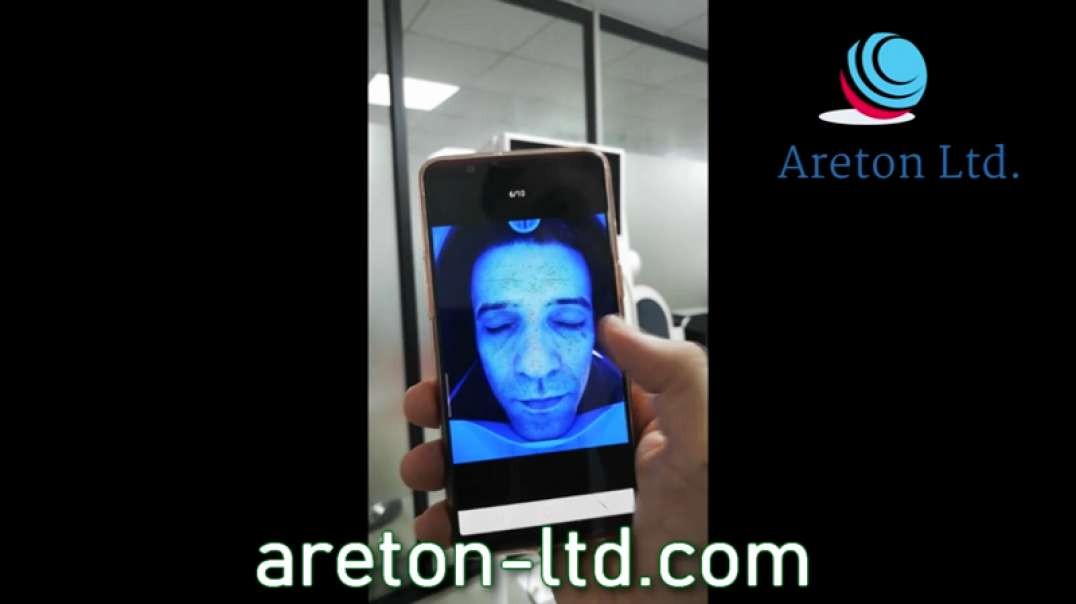 FACIAL ANALYSIS DEVICE DELIVERED ON MOBILE PHONE.mp4