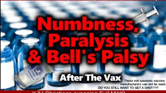 500+ Reported Cases of Numbness, Paralysis, or Bell's Palsy After Covid Vacx; VAERS Data Walkthrough