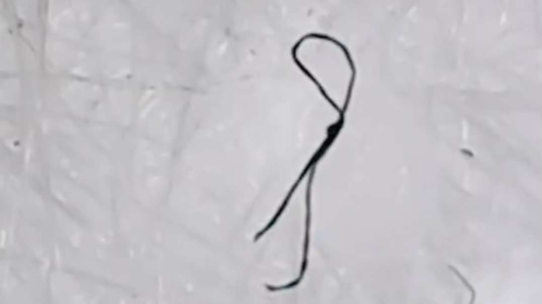 Found on Masks & Swabs - Moving Black Strands / Parasites - What the heck are they?