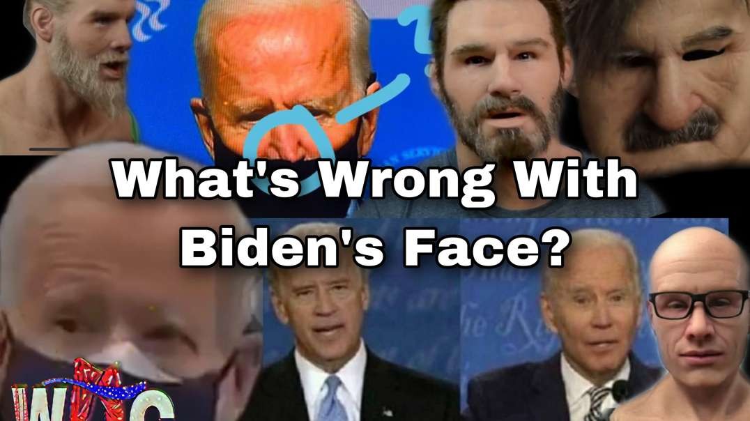 What's Wrong With Biden's Face