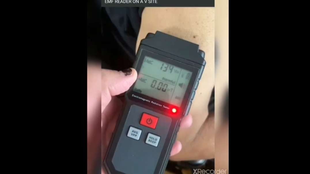 EMF Readings at Injection Site