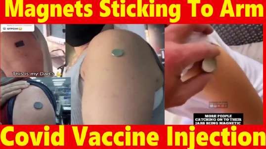 Magnets Sticking To Arm of Covid Vaccine Injection