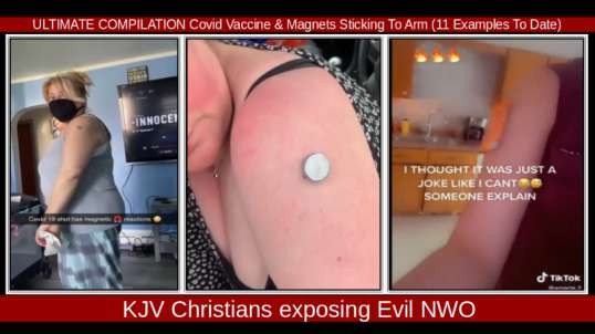 ULTIMATE COMPILATION Covid Vaccine & Magnets Sticking To Arm (11 Examples To Date)