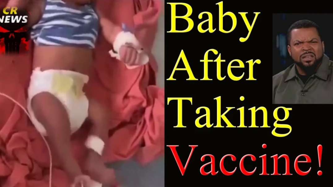 LOOK AT WHAT THE VACCINE DID TO AN INFANT!!!!