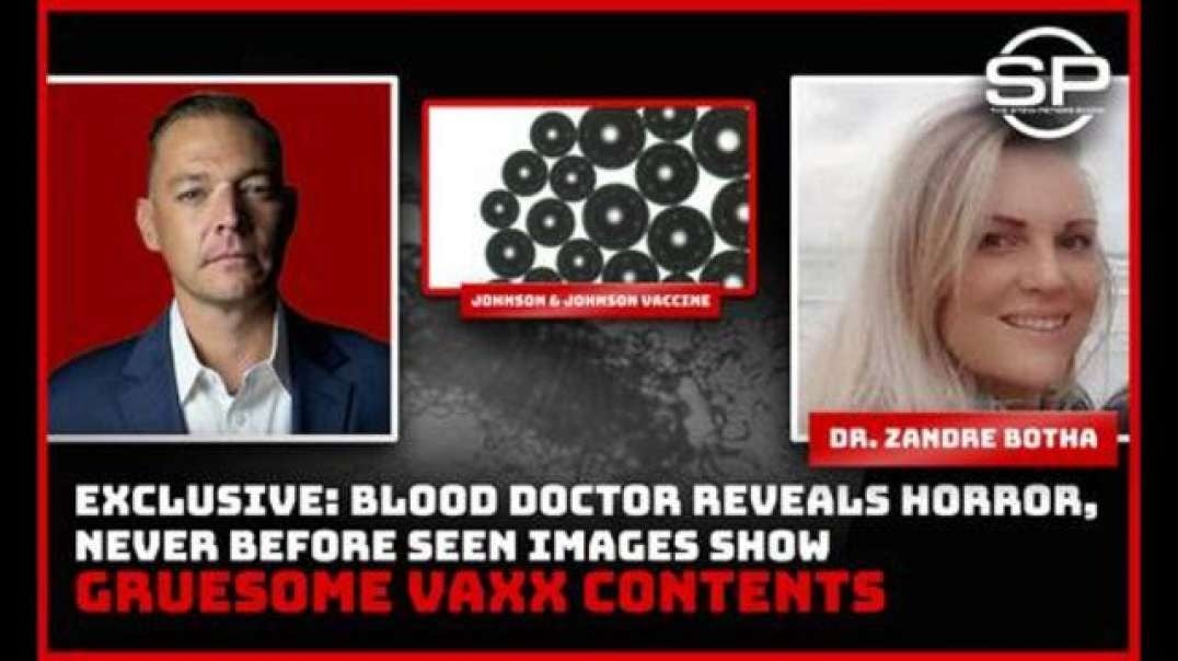 BLOOD DOCTOR REVEALS HORRIFIC FINDINGS [2021-10-04] - DR. ZANDRE BOTHA & STEW PETERS (VIDEO)