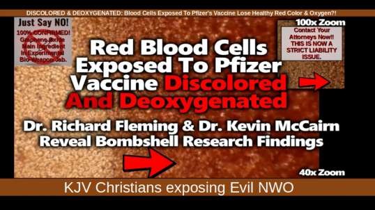 DISCOLORED & DEOXYGENATED: Blood Cells Exposed To Pfizer's Vaccine Lose Healthy Red Color & Oxygen?!