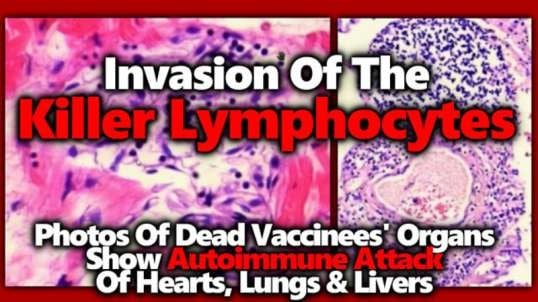 Vaccinee Autopsies Killer Lymphocytes Invade Vital Organs, Drs Sucharit Bhakdi & Michael Palmer
