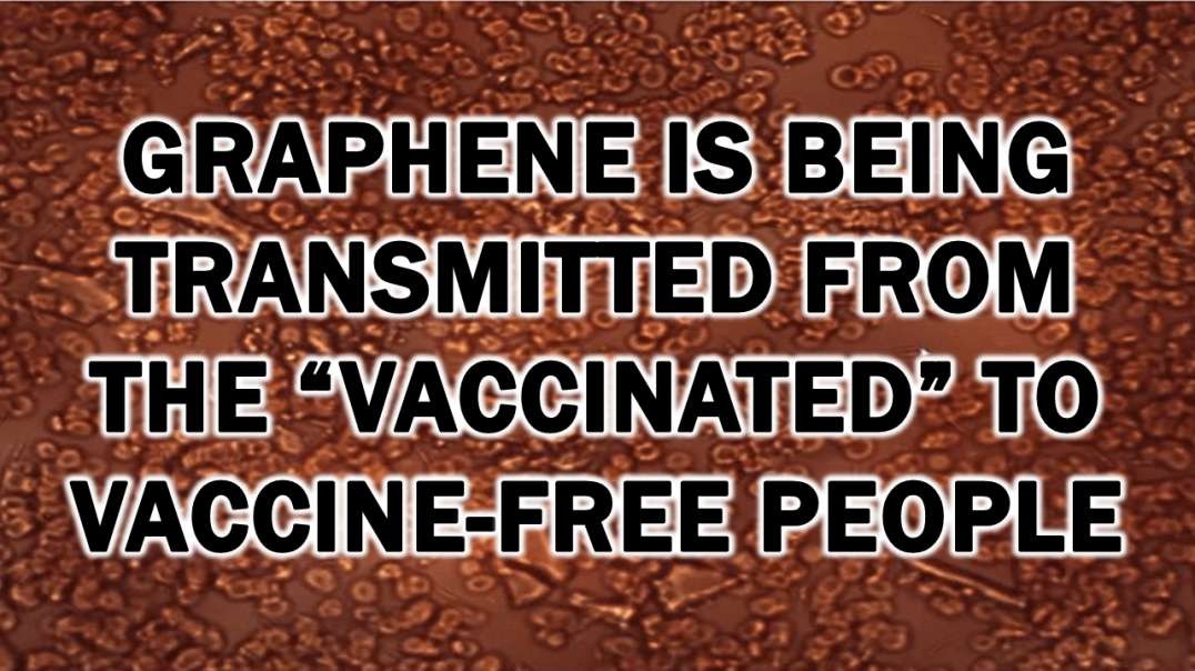 [Expose Mirror] Graphene Is Being Transmitted from the “Vaccinated” to Vaccine-Free People