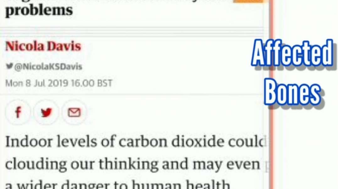 CO2 (MASKS?) AFFECTED BRAINS BONES KIDNEYS