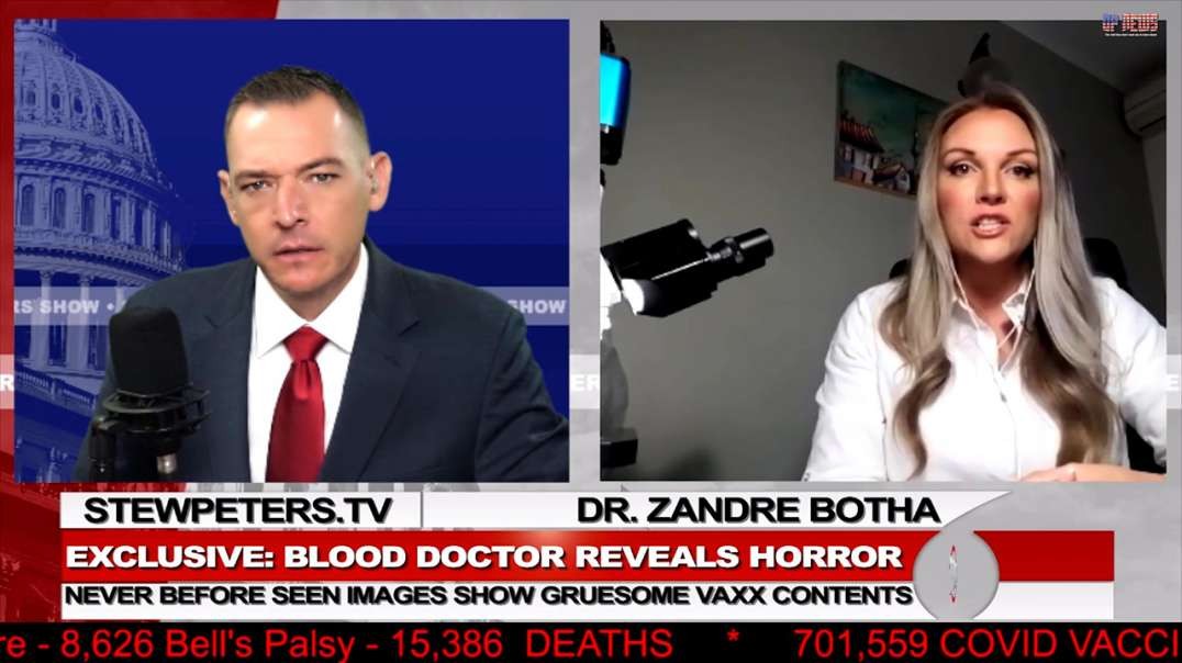 Dr. Zandre Botha Reveals Metallic "Self-Assembling" Object In Blood of People Who Received COVID Vax