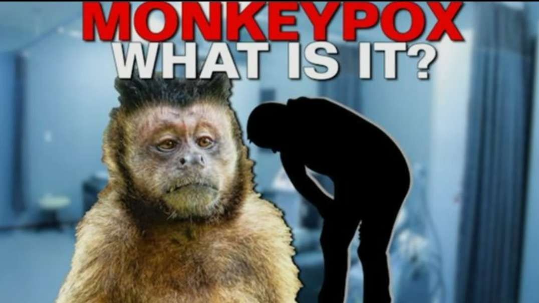 Monkeypox Virus Now Confirmed In US, Sweden, UK, Portugal and Spain.mp4