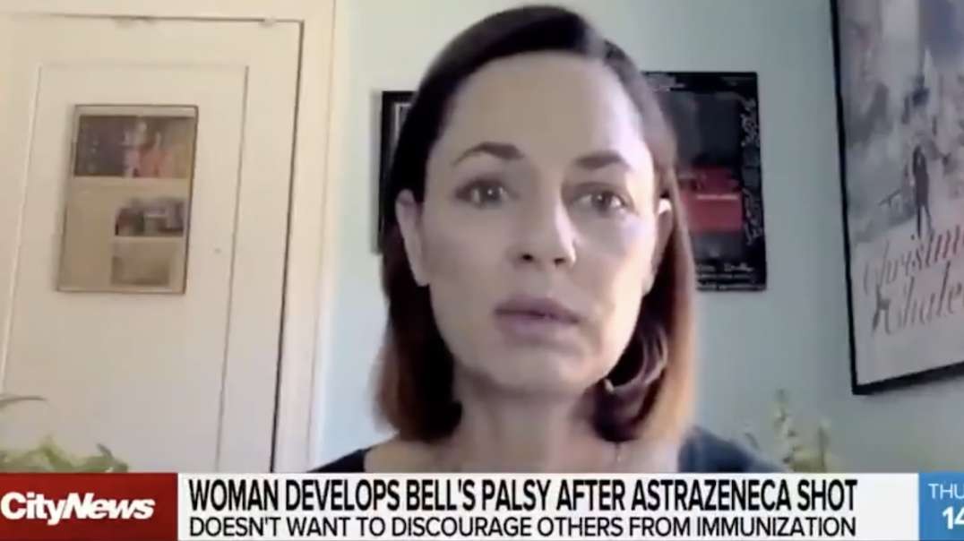 [AUGUST 2021] CANADIAN WOMAN GETS BELL'S PALSY FROM COVID VAX & STILL TELLS OTHERS TO GET IT