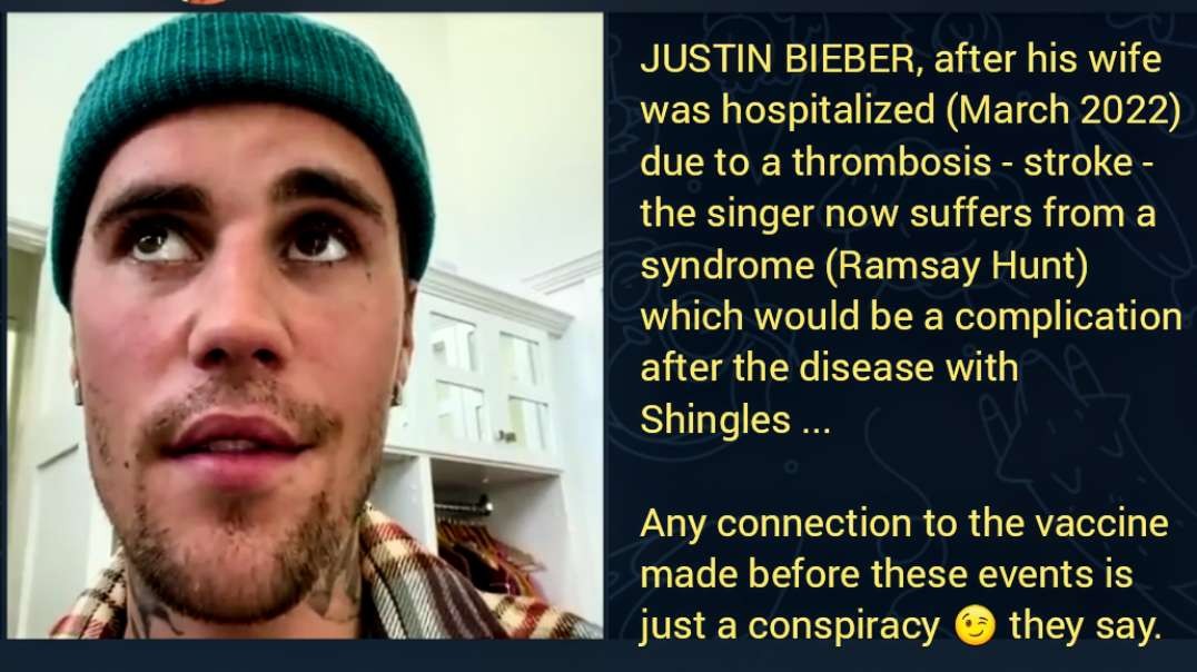 JUSTIN BIEBER after his wife was hospitalized (March 2022) due to a thrombosis - stroke - the singer now suffers from a syndrome (Ramsay Hunt) which would be a complication after the disease 