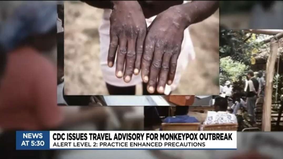 CDC issues new travel guidelines as monkeypox continues to spread.mp4