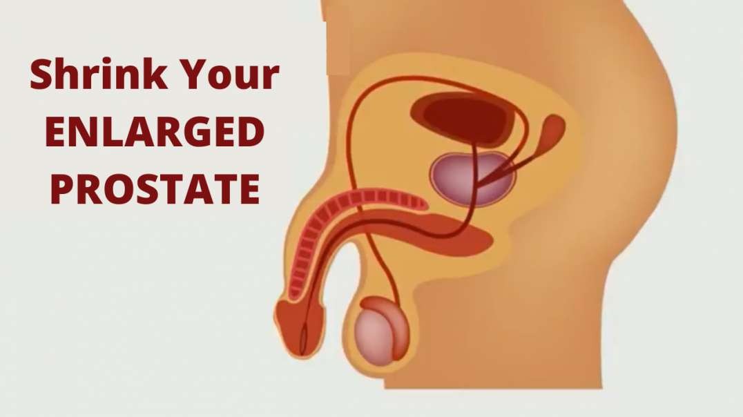Shrink Prostate Enlargement Without Surgery
