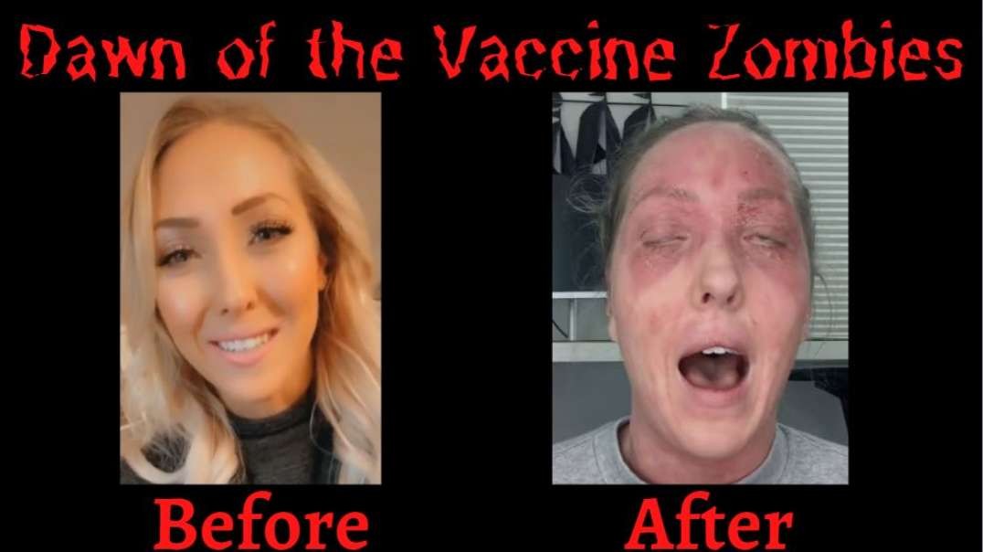 Covid Vaccine turns Woman into ZOMBIE!