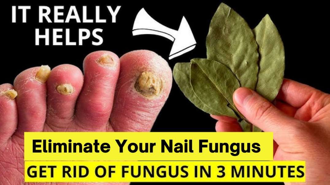 Do This To Cure Nail Fungus!