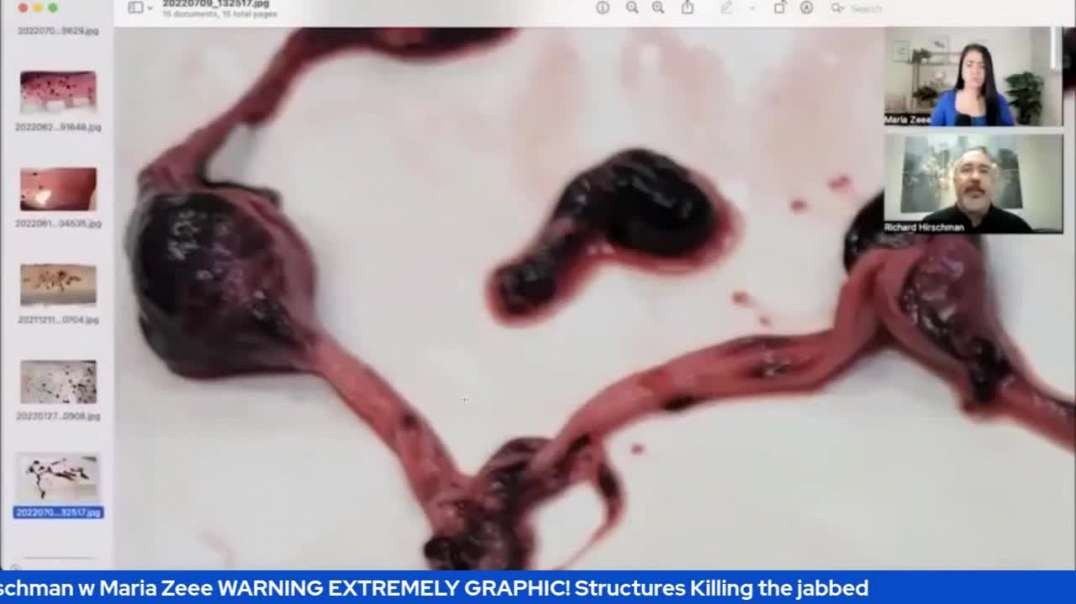 Rich Hirschman w Maria Zeee WARNING EXTREMELY GRAPHIC! Structures Killing the jabbed