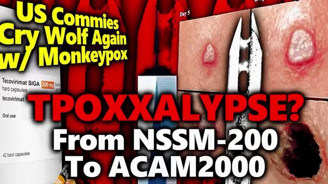 timtruth No Mention of Impaired Sperm or Deadly Shedding Media Pushes TPOXX & US 100M Doses Of ACAM2000.mp4