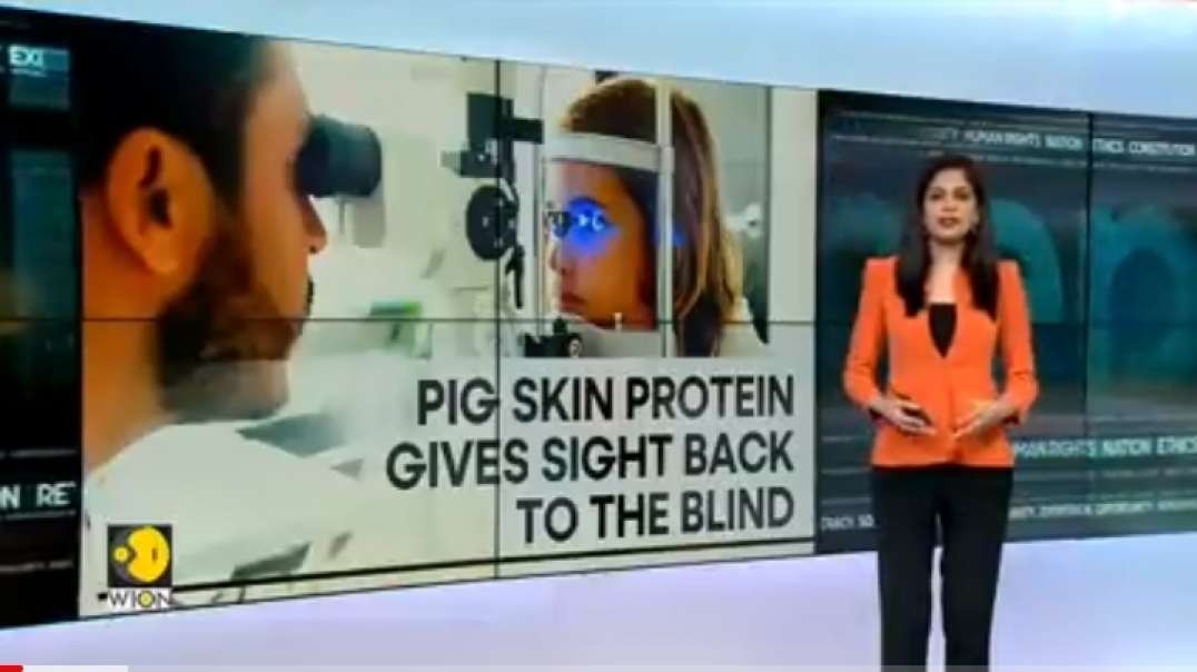 WION Fineprint _ Cornea made from pig skin restores sight, minimally invasive tr.mp4