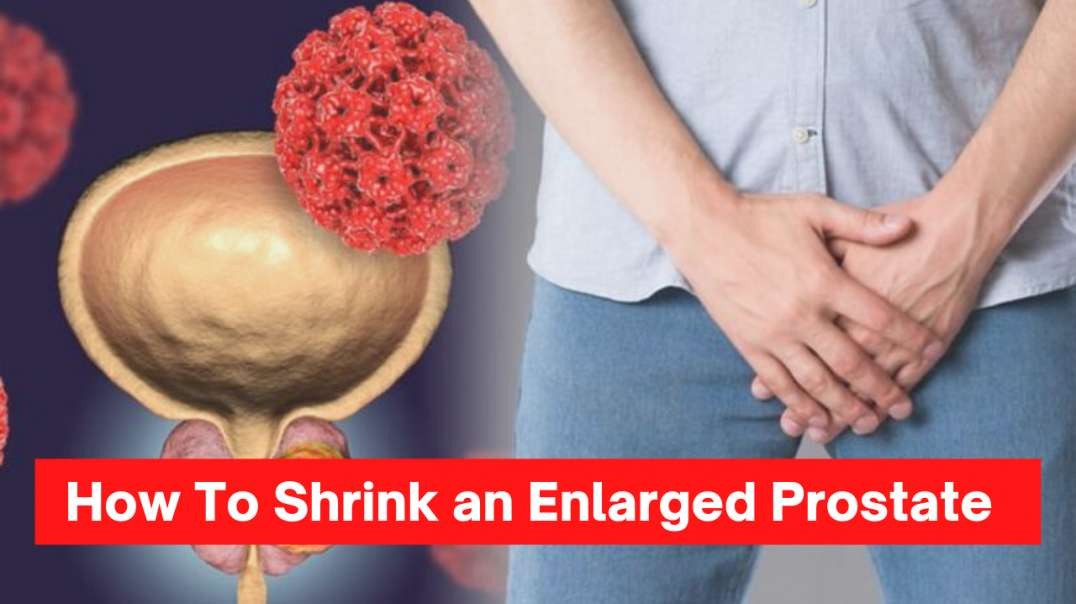 The Real Cure for Prostate Enlargement!