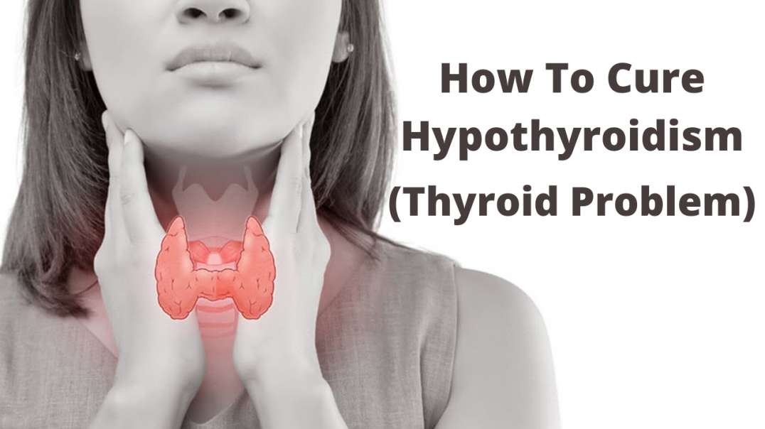 How To Cure Thyroid ( Hypothyroidism )